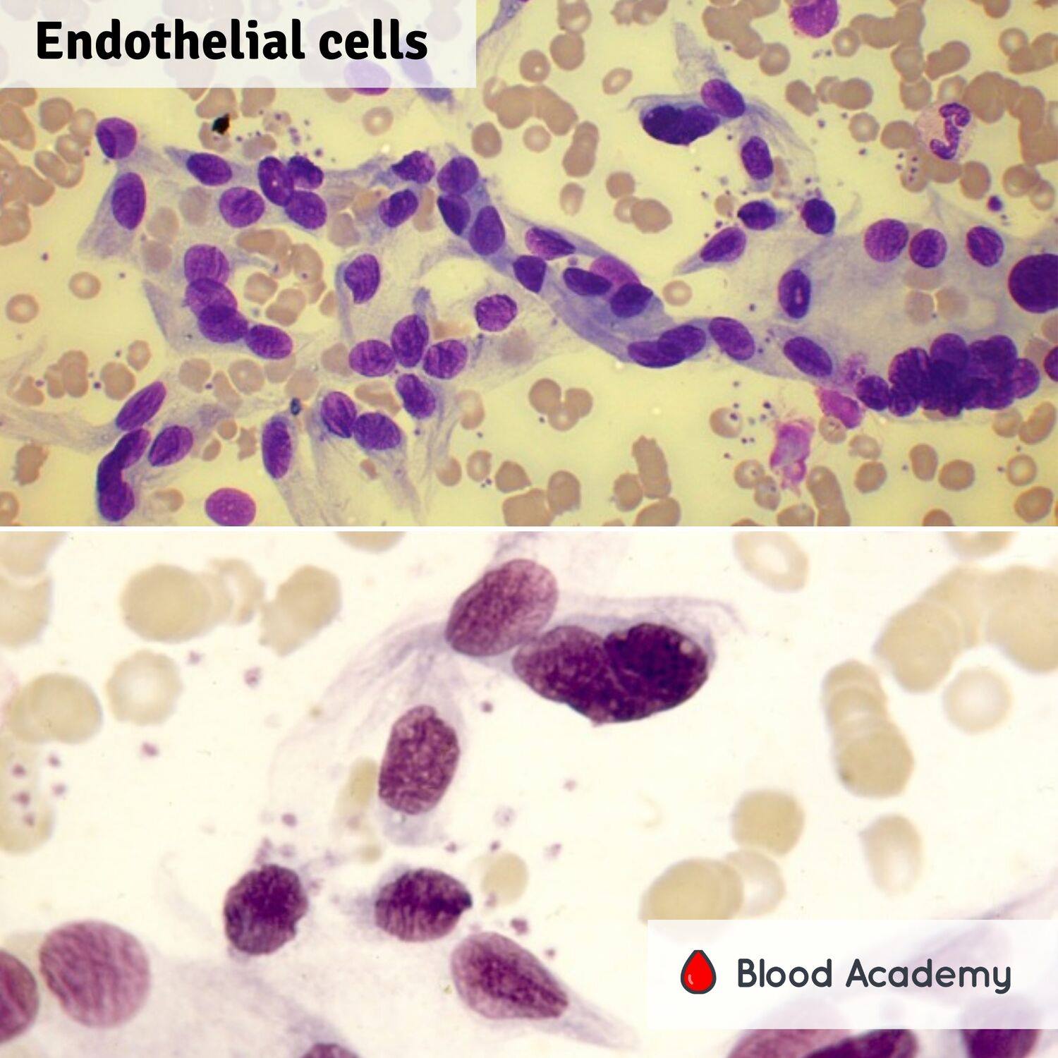 Endothelial cells - Blood Academy