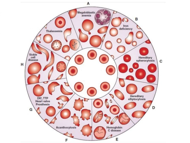 Essential Blood Cell Morphology - Blood Academy